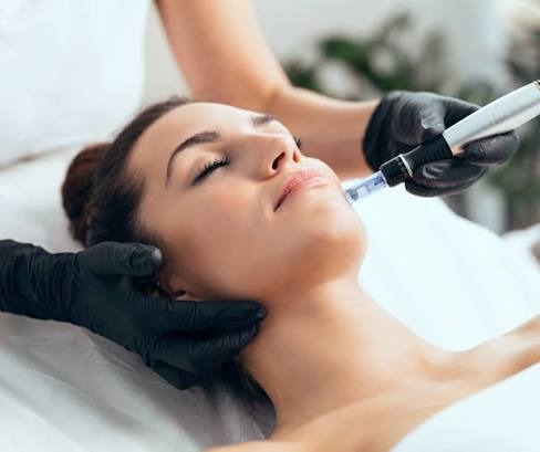 Microneedling facial skin rejuvenation treatment at Nail Bahar salon.